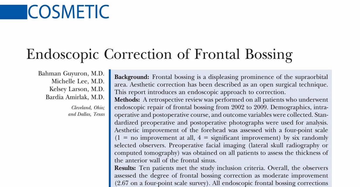 Endoscopic correction of frontal bossing