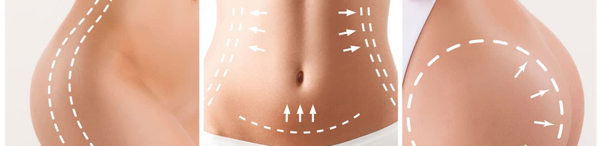 laser liposuction amirlak plastic surgery dallas texas