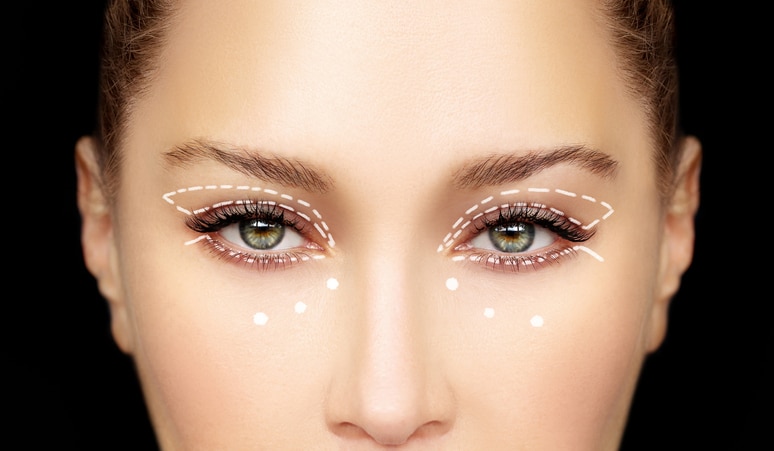 define blepharoplasty